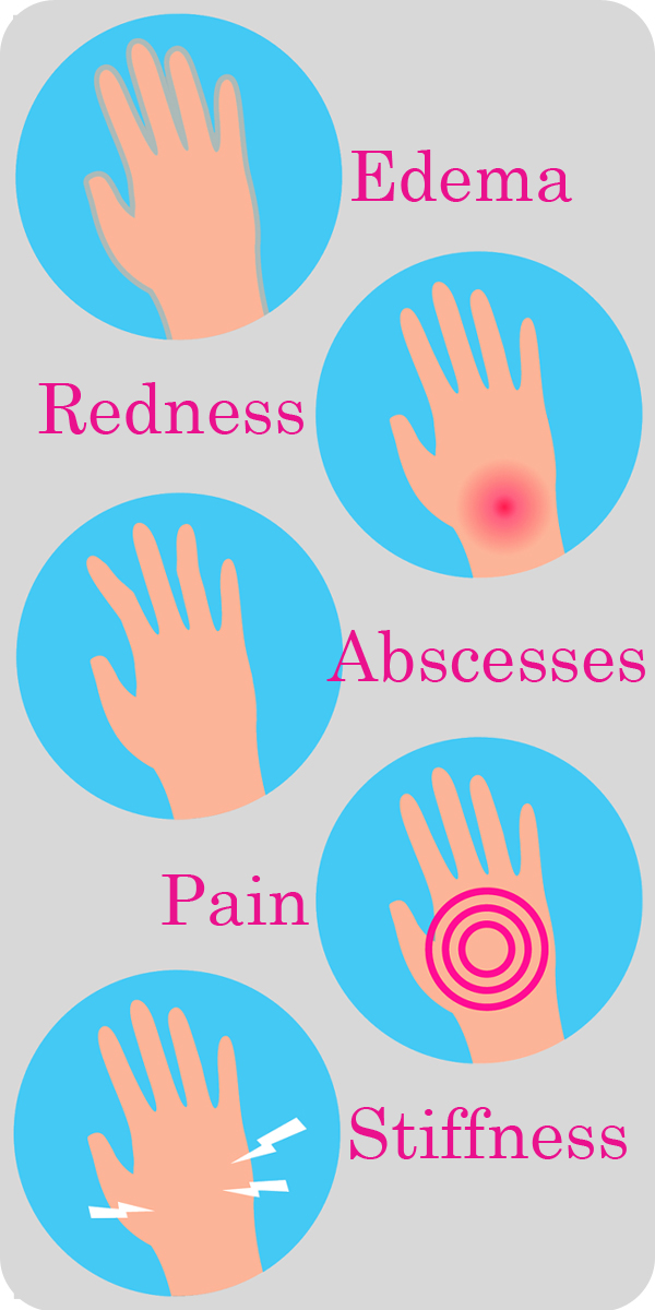 What does Arthritis Feel Like-What does Arthritis Look Like-Explained In Graphics-Pain-Redness-Edema-Stiffness-Abcesses